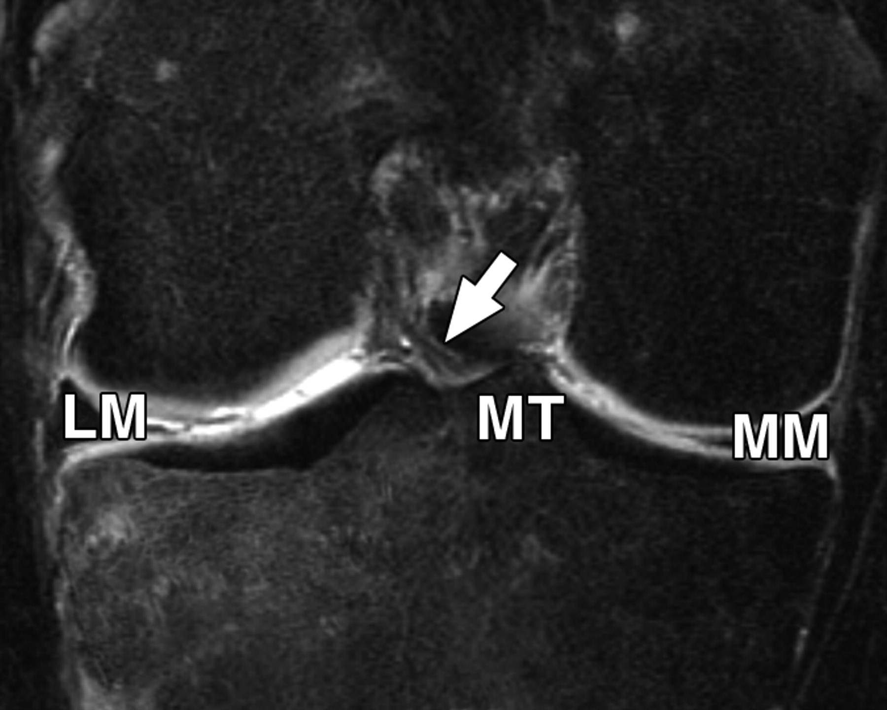 107f7f7cbccc5f7ef7f135a981bab0b2.jpeg 107f7f7cbccc5f7ef7f135a981bab0b2.jpeg