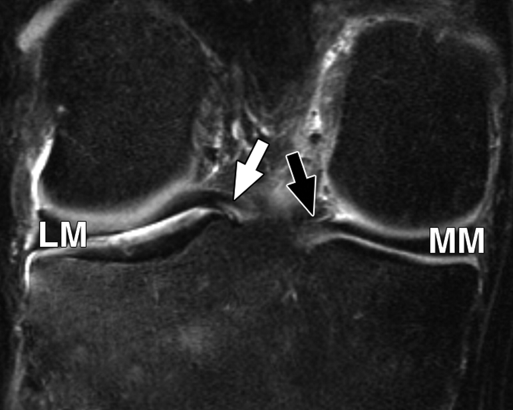 5520cf3c3107bcbe16a450c0ac30f232.jpeg 5520cf3c3107bcbe16a450c0ac30f232.jpeg