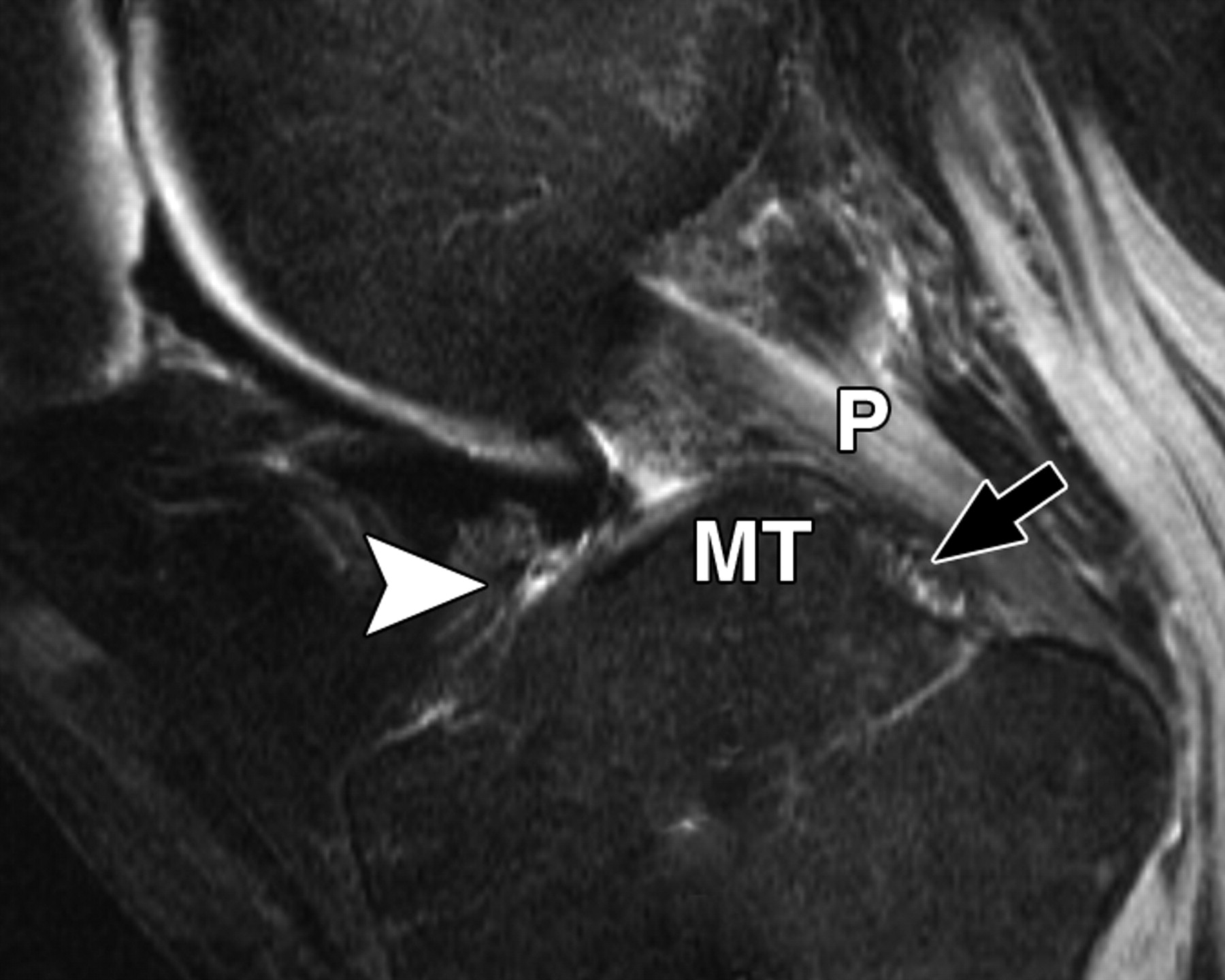 56ddb74b91044972475ef5d11ebdf151.jpeg 56ddb74b91044972475ef5d11ebdf151.jpeg