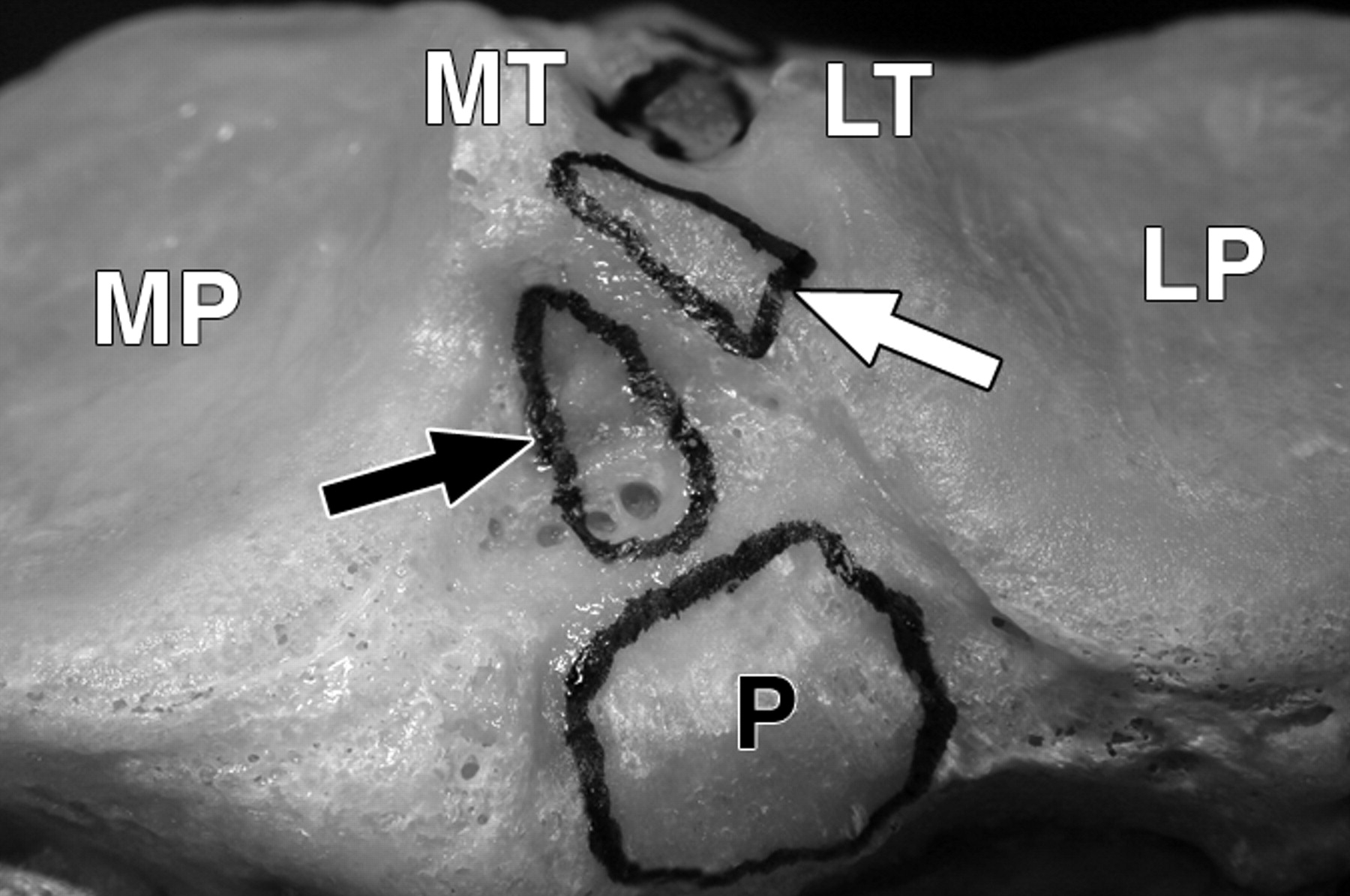 601f9e56c569d9e0b81247771827e666.jpeg 601f9e56c569d9e0b81247771827e666.jpeg