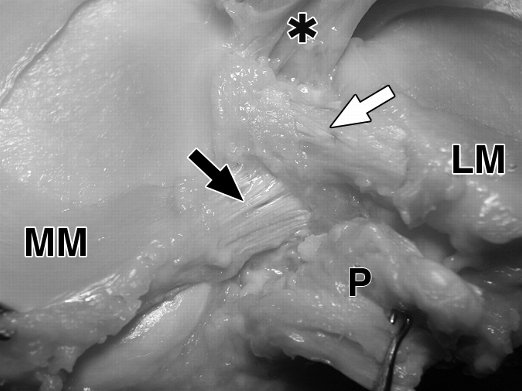 876e6aa3ed959ec44608ba1418643771.jpeg 876e6aa3ed959ec44608ba1418643771.jpeg