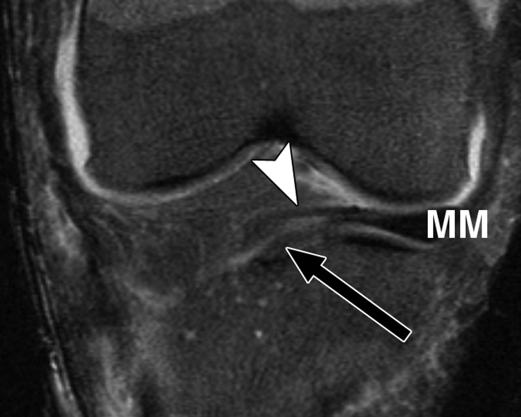 ada45784ed7dd56fa1d17c892210c599.jpeg ada45784ed7dd56fa1d17c892210c599.jpeg