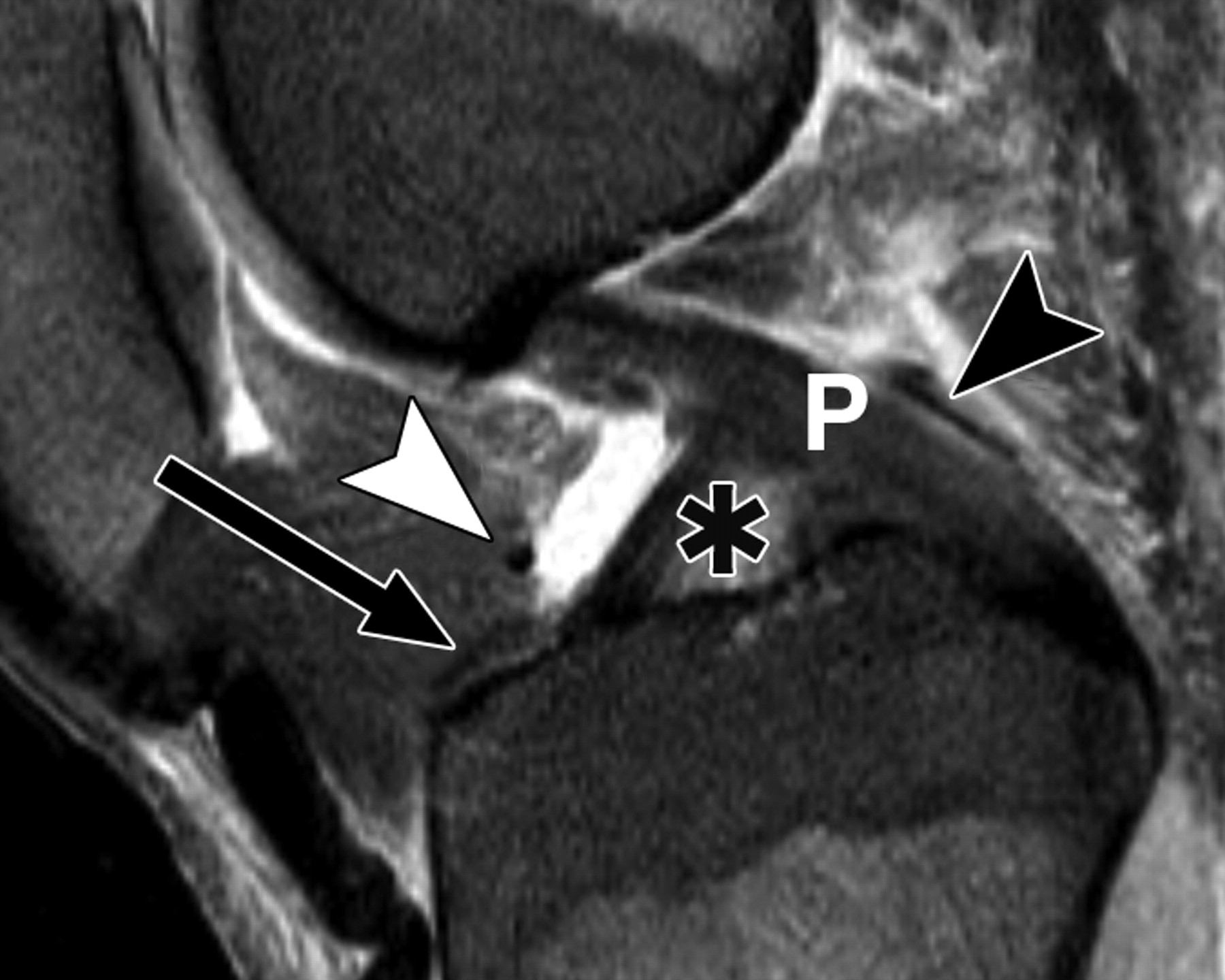 ceae63087eb77753c66b161130d735bf.jpeg ceae63087eb77753c66b161130d735bf.jpeg