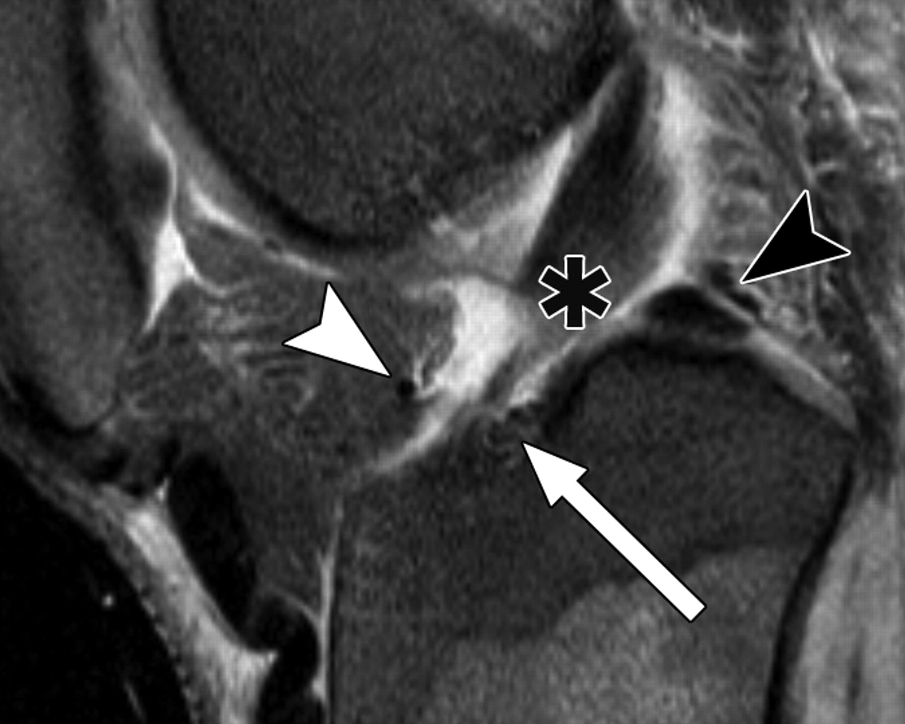 eb13babf5e9b8d8f8cdc165a92bdcb48.jpeg eb13babf5e9b8d8f8cdc165a92bdcb48.jpeg