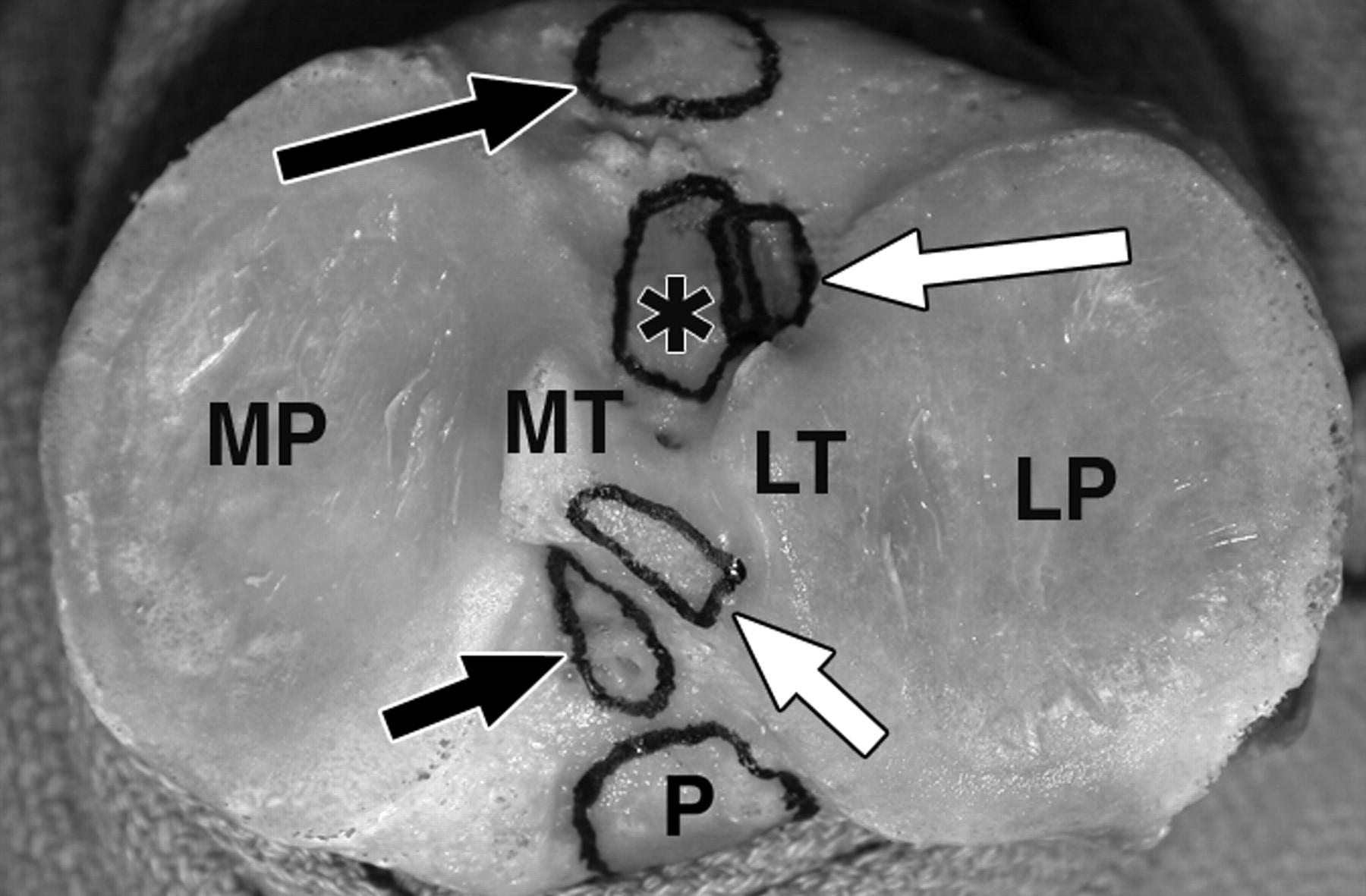 f862b6cff7f721a1529142d7c1ec8b07.jpeg f862b6cff7f721a1529142d7c1ec8b07.jpeg